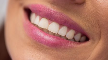 Close-Up of Female Patient Undergoing Dental Treatment at a Clinic Close-Up of Female Patient Undergoing Dental Treatment at a Clinic